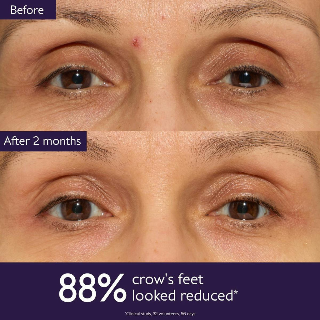 Anti-Aging Eye Cream for Fine Lines and Wrinkles