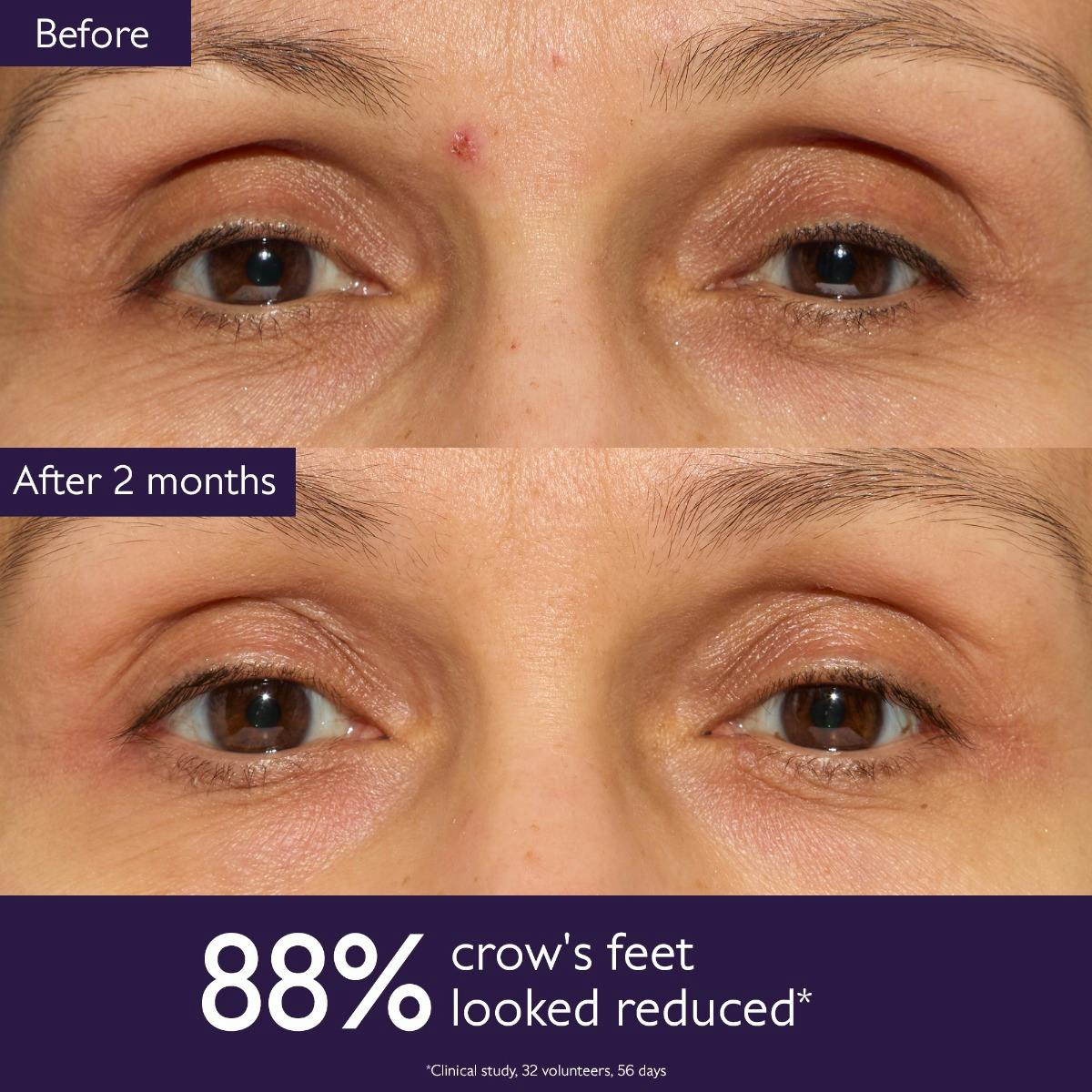 Anti-Aging Eye Cream for Fine Lines and Wrinkles