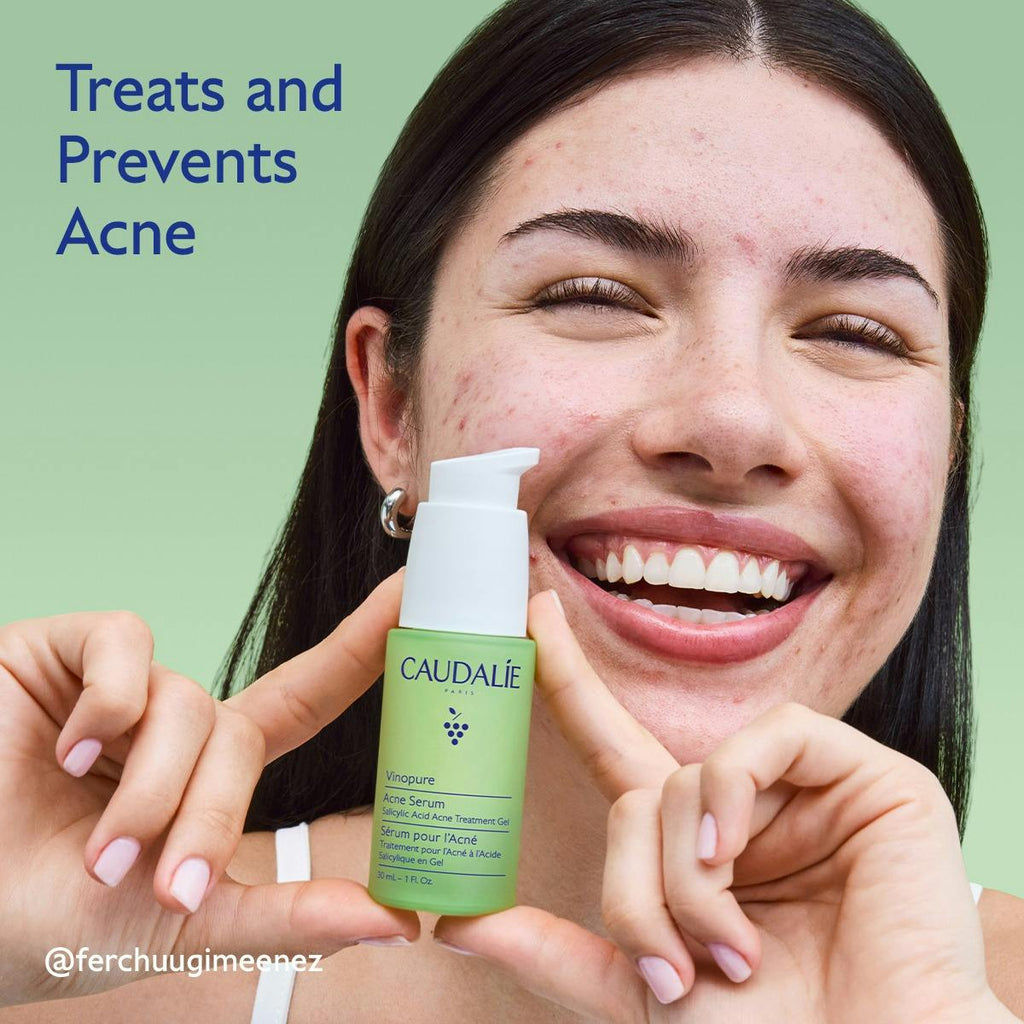 Acne Serum to Treat and Prevent Blemishes