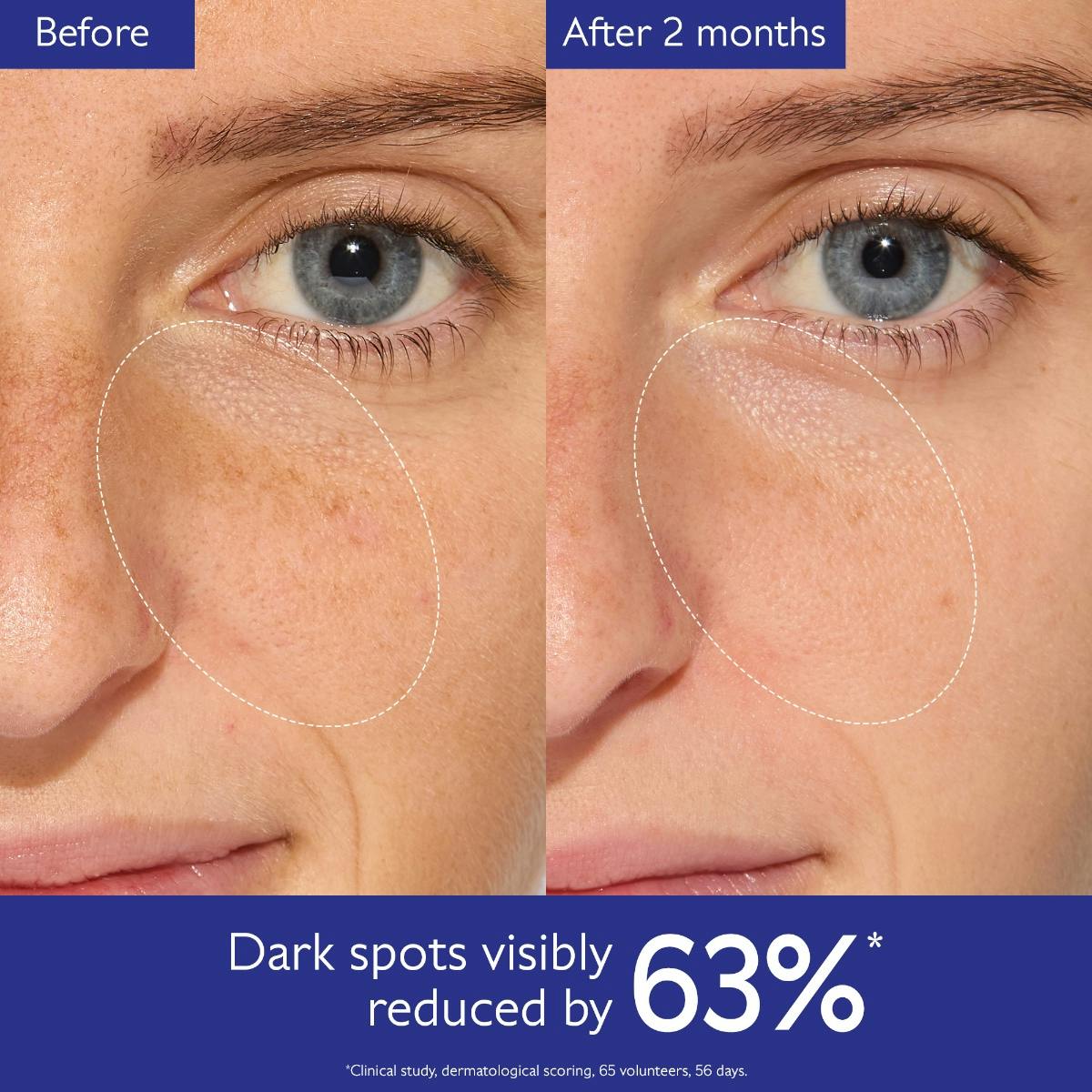 Vinoperfect Brightening Routine for Dark Spots and Uneven Skin Tone