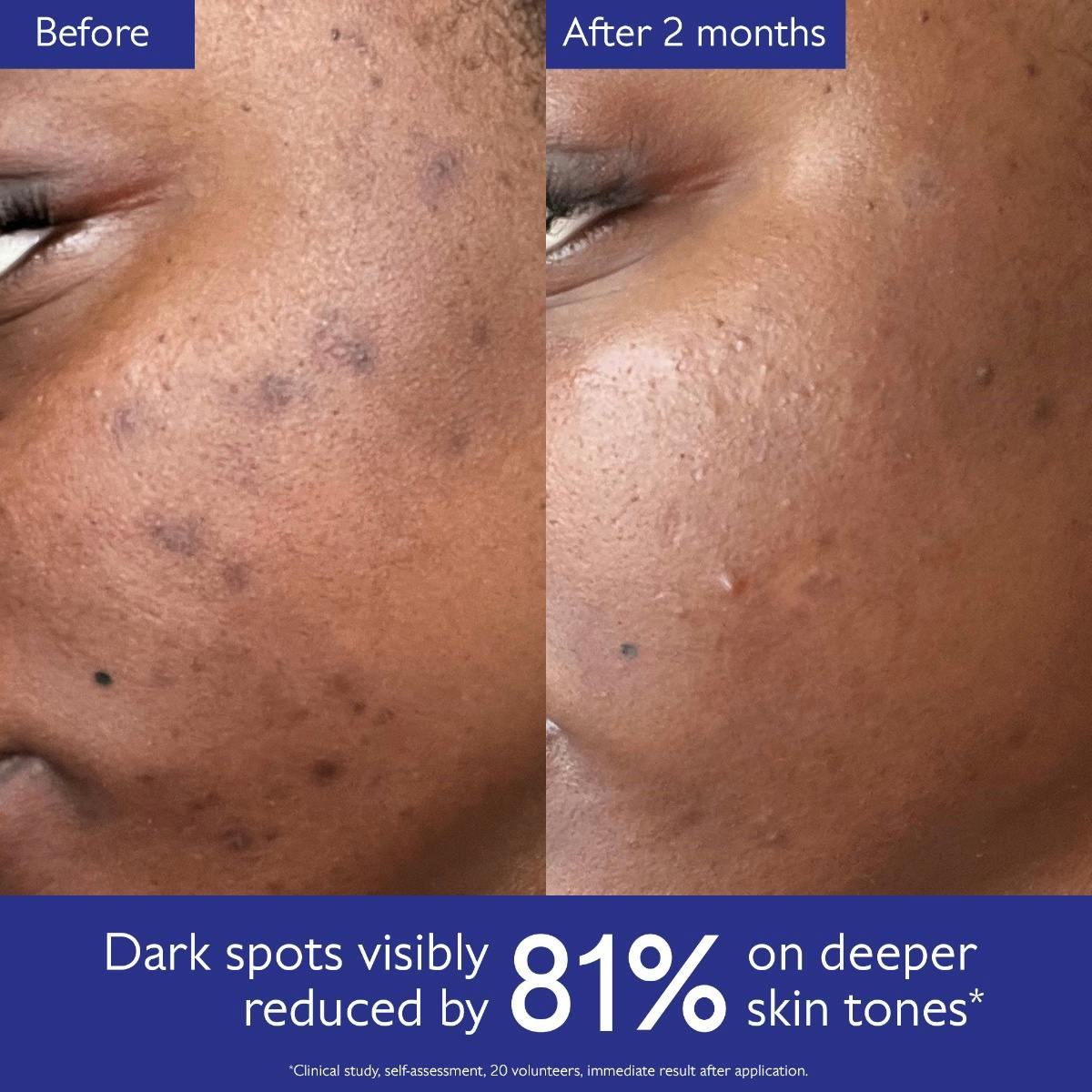 Vinoperfect Brightening Routine for Dark Spots and Uneven Skin Tone