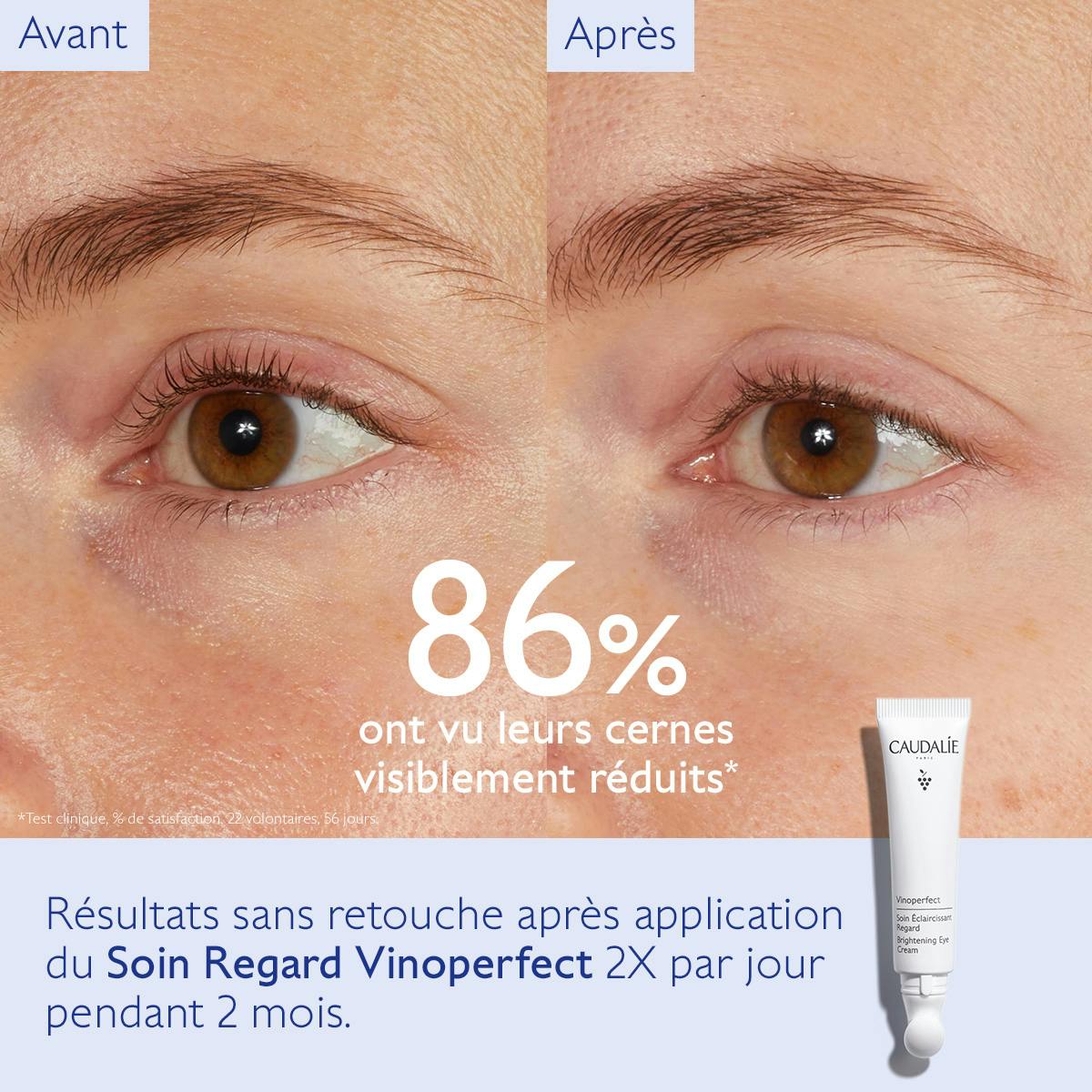 Dark Circle Brightening Eye Cream with Niacinamide