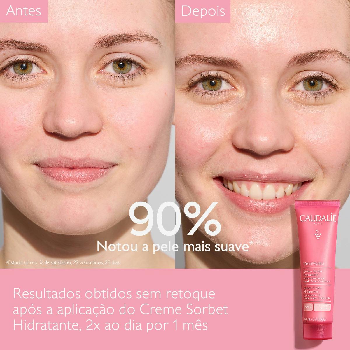 Sorbet Cream Moisturizer with Hyaluronic Acid