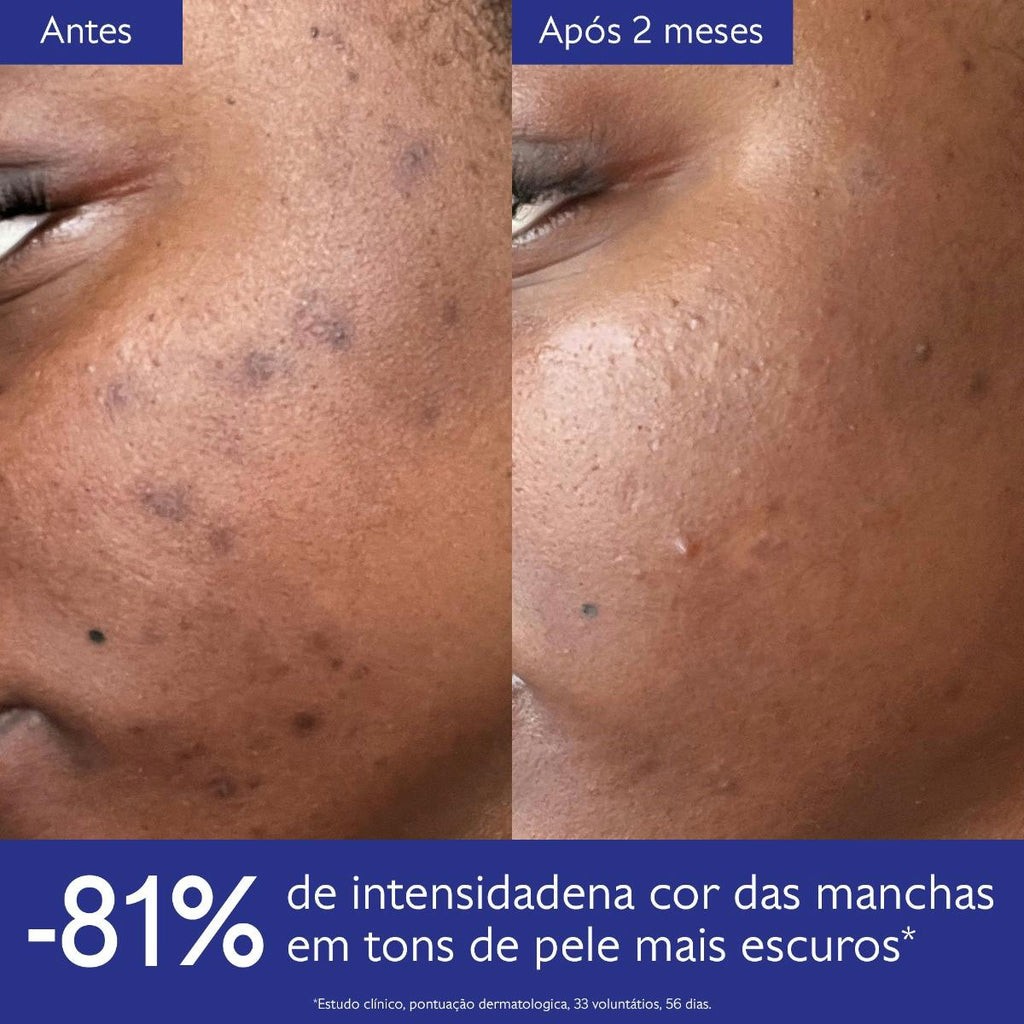 Vinoperfect Brightening Routine for Dark Spots and Uneven Skin Tone