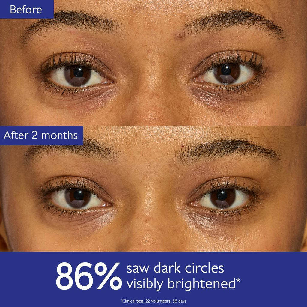 Dark Circle Brightening Eye Cream with Niacinamide