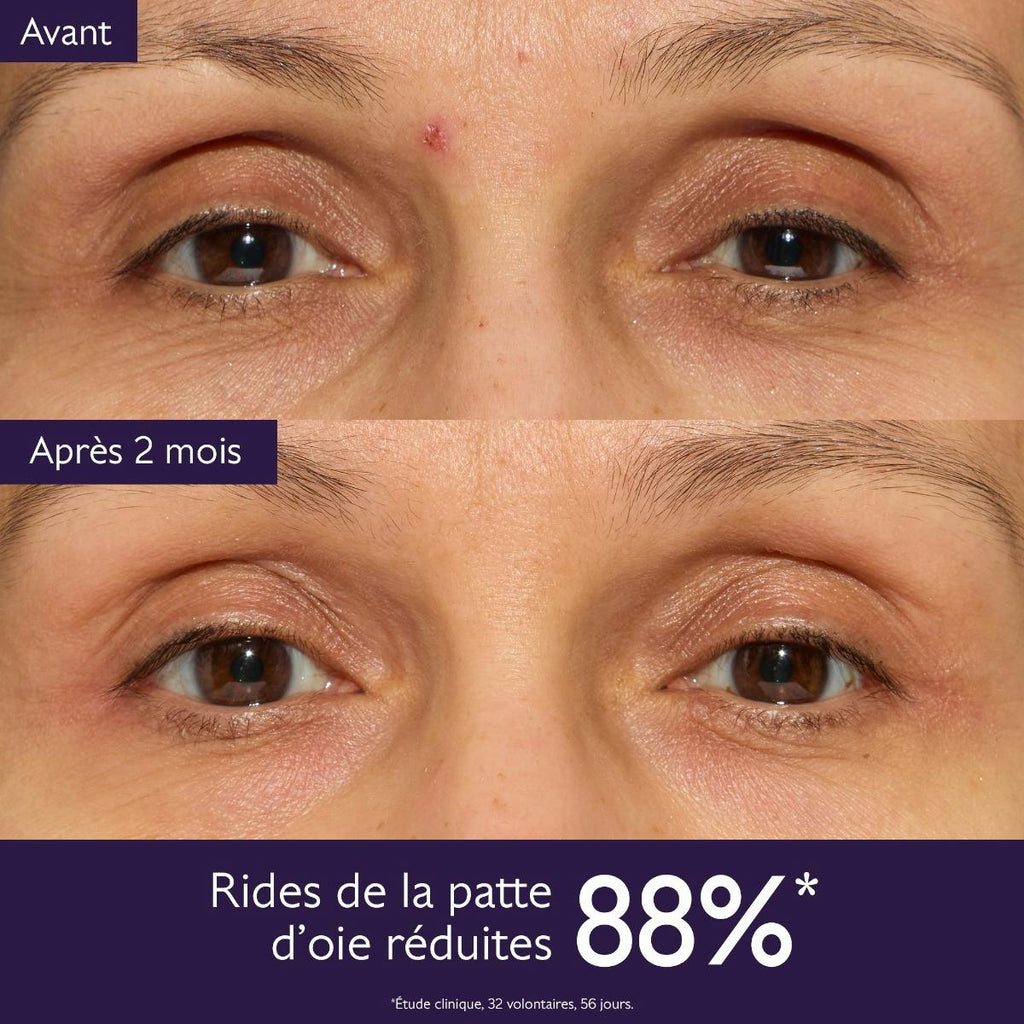 Anti-Aging Eye Cream for Fine Lines and Wrinkles