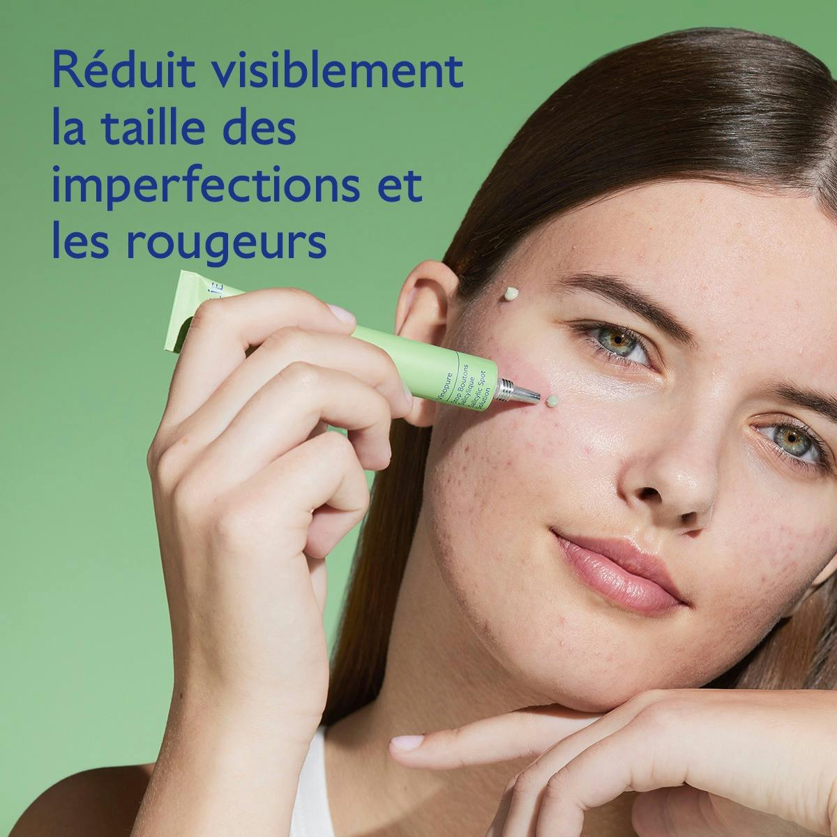 Targeted Spot Solution with Salicylic Acid