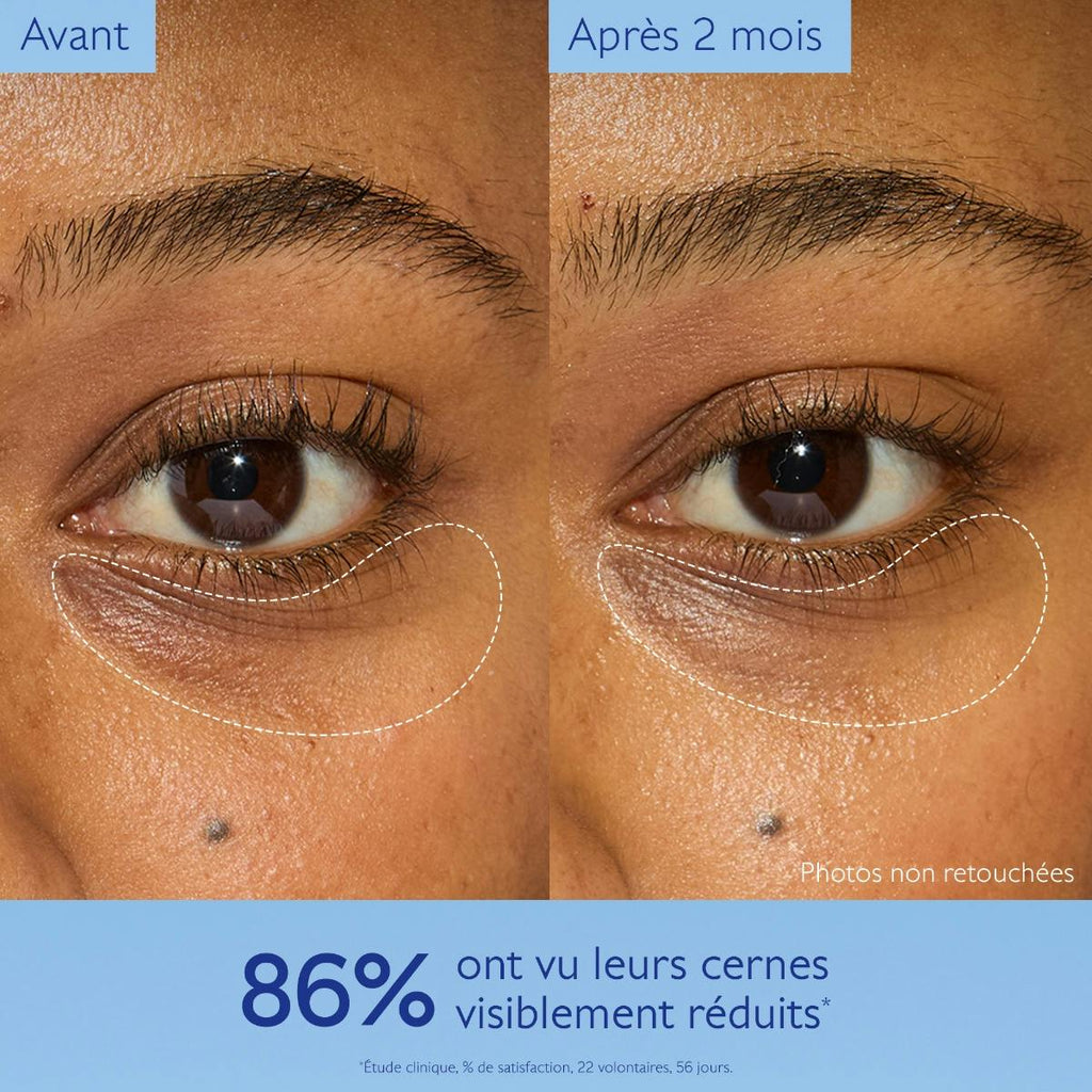Dark Circle Brightening Eye Cream with Niacinamide