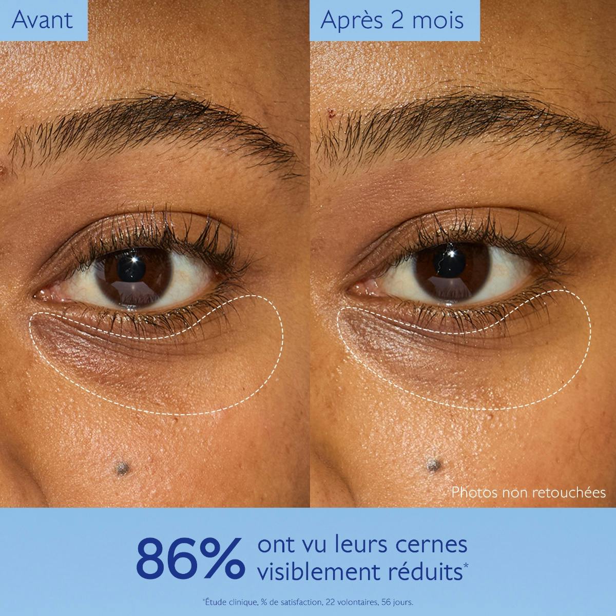 Dark Circle Brightening Eye Cream with Niacinamide