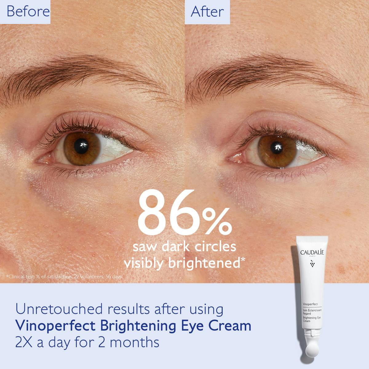 Dark Circle Brightening Eye Cream with Niacinamide