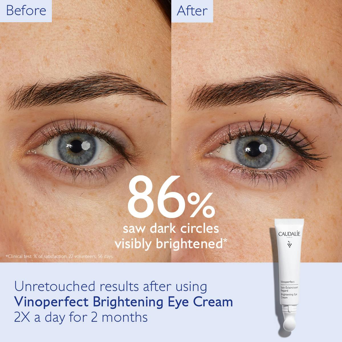 Dark Circle Brightening Eye Cream with Niacinamide