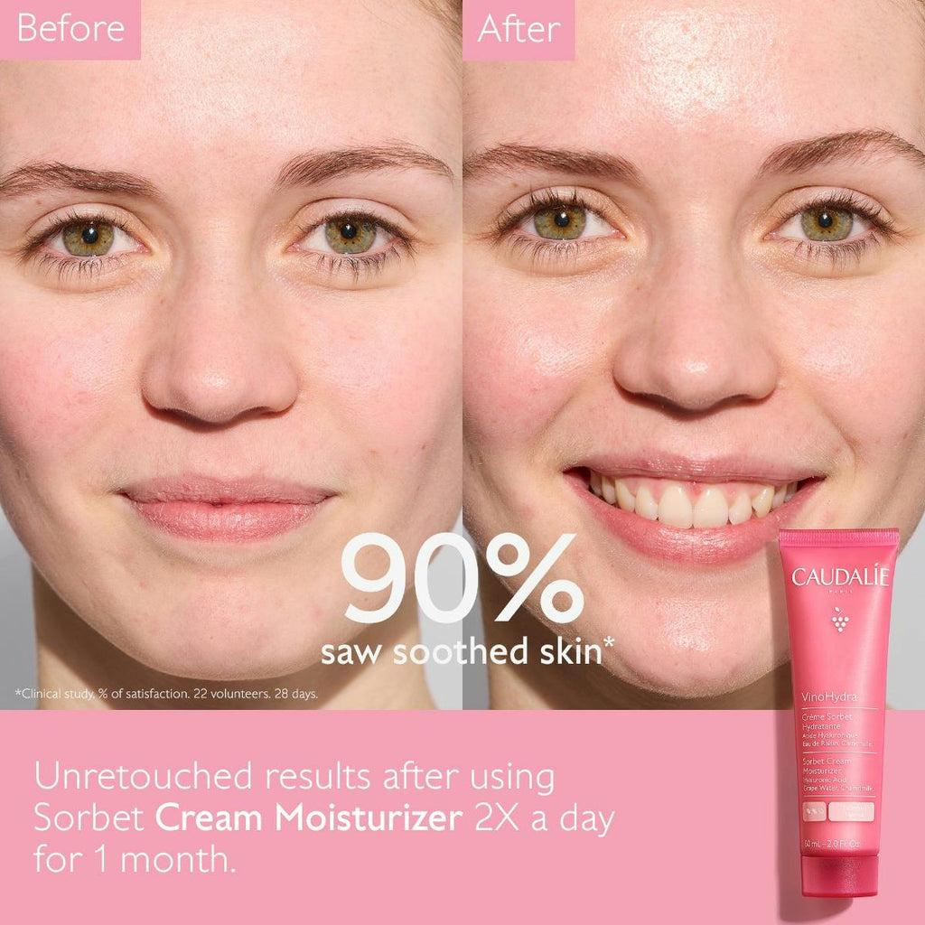 Sorbet Cream Moisturizer with Hyaluronic Acid